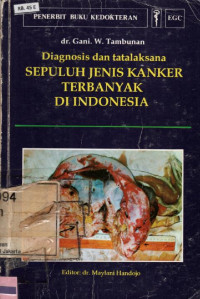 Image of Diagnosis dan tatalaksana Sepuluh Jenis Kanker Terbanyak Di Indonesia