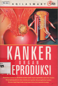 Image of Kanker Organ Reproduksi