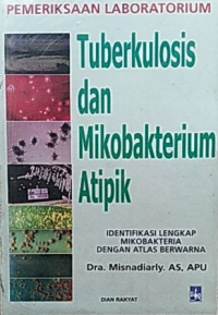 Pemeriksaan Laboratorium Tuberkulosis dan Mikobakterium