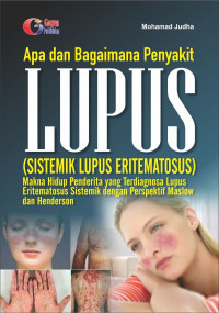 Image of Apa dan Bagaimana Penyakit LUPUS (Sistemik Lupus Eritematosus) Makna Hidup Penderita Yang Terdiagnosa Lupus Eritematosus Sistemik dengan Perspektif Maslow dan Henderson