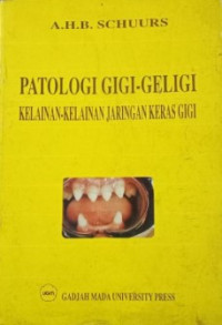 Patologi gigi-geligi Kelainan kelainan jaringan keras gigi