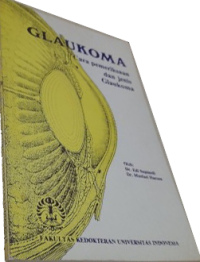 Image of Glaukoma : cara pemeriksaan dan jenis glaukoma