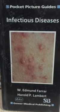 Image of Infectious Diseases (Pocket Picture Guides To clinical Medicine)