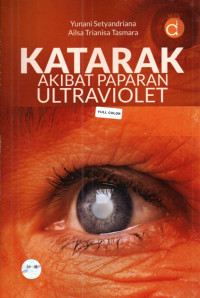 Image of Katarak Akibat Paparan Ultraviolet